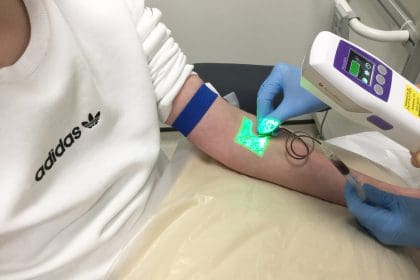 Accuvein device