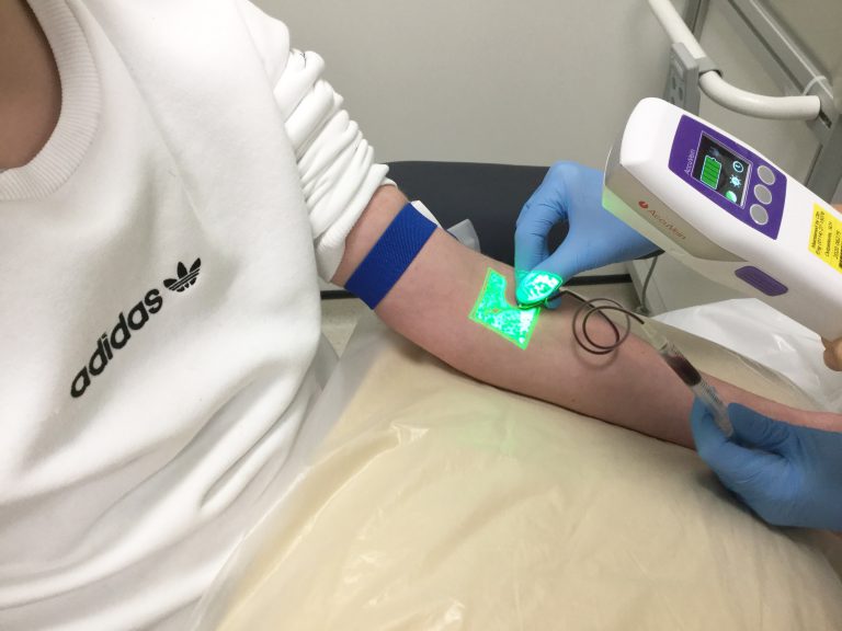 new-vein-scanner-makes-blood-tests-easier-medequip4kids